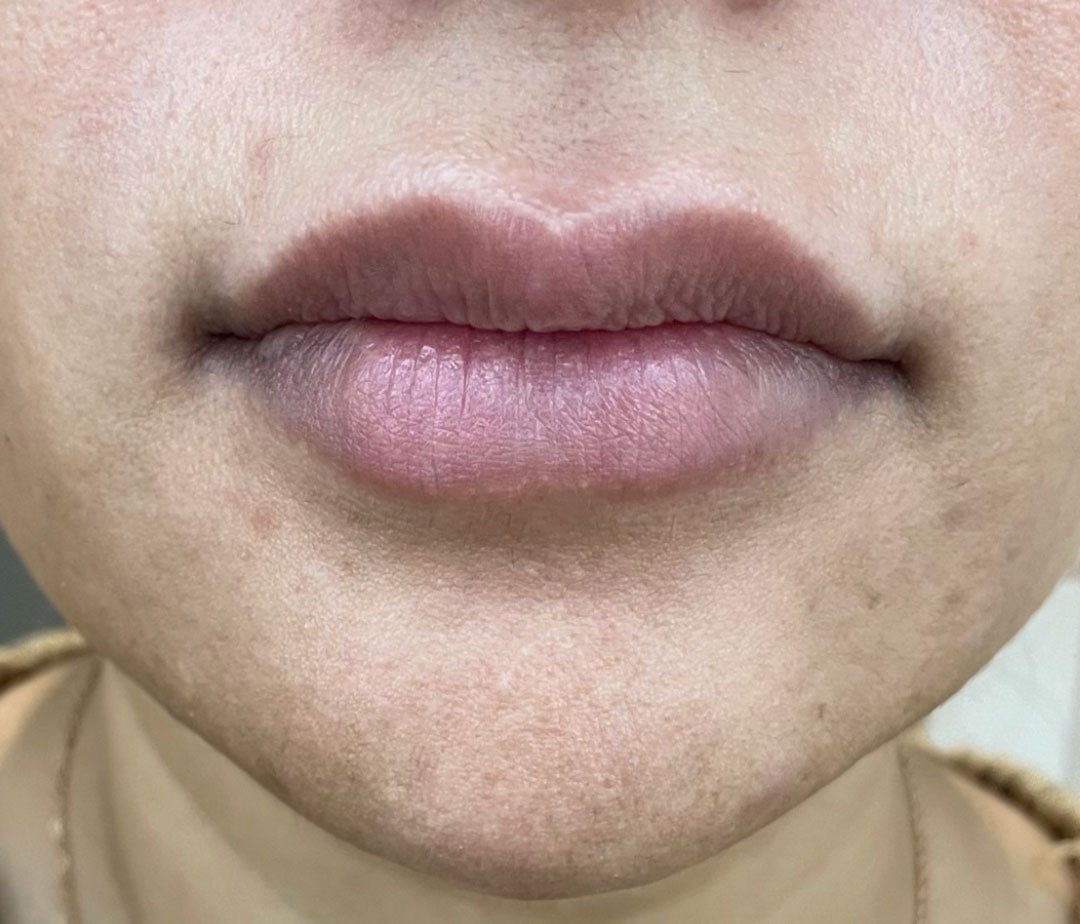 Before and after transformation results using our dark spot and pigmentation mask